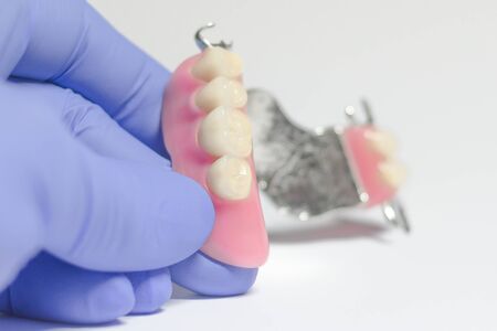 partial denture of the upper jaw in the hands of a dentistの写真素材
