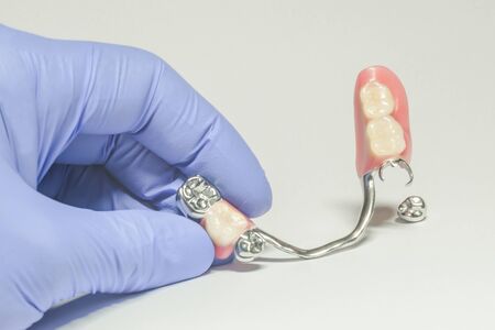partial arch prosthesis of the lower jaw with metal crowns in the hands of the dentistの写真素材