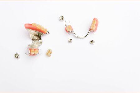 removable clasp prosthesis on the upper and lower jaw with metal and ceramic-metal crownsの写真素材
