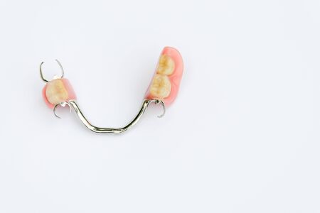 arch prosthesis on the lower jaw without crownsの写真素材