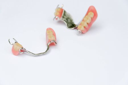 removable clasp prostheses without supporting crownsの写真素材
