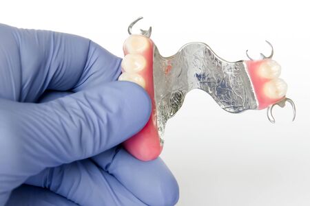 removable clasp prosthesis with clam fixation on the upper jaw in the hands of the dentistの写真素材