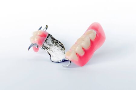 clasp prosthesis with clam fixation on the upper jaw isolated on a white backgroundの写真素材