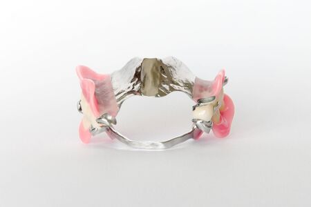 set of partial removable clasp clasps on the upper and lower jawsの写真素材