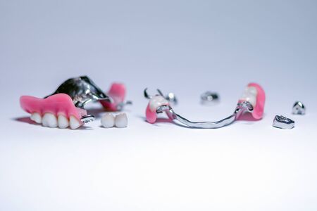 orthopedic dentistry. types of dental prosthetics. removable clasp prostheses with supporting metal and ceramic crownsの写真素材
