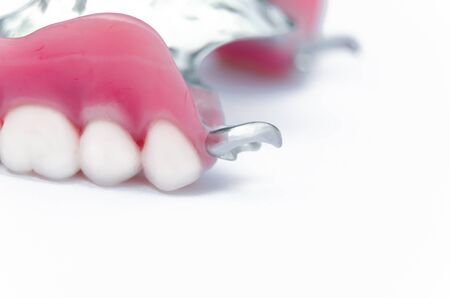 Clam removable denture on the upper jaw. false teeth on the upper jaw. orthopedic dentistry. dental prostheticsの写真素材