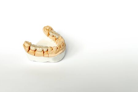 orthopedic dentistry. tooth replacement concept. dental prosthetics. cermet teeth. ceramic bridges. gypsum model of the jaw and teeth. White backgroundの写真素材
