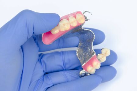 upper denture in the hands of a dentist. blue glove. clasp prosthesis. false teeth. ceramic-metal crownsの写真素材
