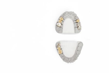 Orthopedic dentistry background. dental prosthetics background. concept of artificial teeth. teeth isolatedの写真素材