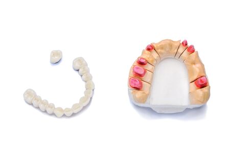 dental prosthetics. tooth restoration. ceramic white teeth. bridge prosthesis. Isolated on a white background. orthopedic backgroundの写真素材