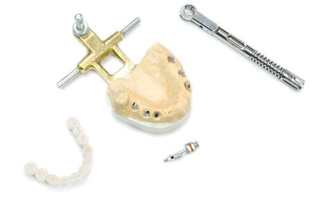 the process of manufacturing ceramic teeth on implants. dental implants with ceramic teeth on a light background. concept of dental implantation and dental prosthetics on implants.の写真素材
