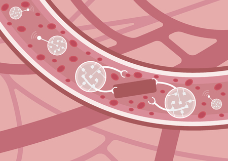 Future of medicine. Nanobots in action. Nanorobots detecting and eliminating thrombus in blood vesselsのイラスト素材