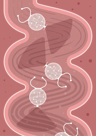 Future of medicine. Nanobots in action. Nanorobots are making a diagnosis of alternative, alternative alternative colonoscopyのイラスト素材