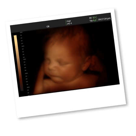 Image of newborn baby like 3D ultrasound of baby in mother s womb の写真素材