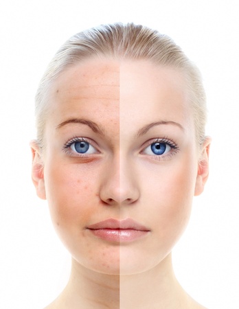 Beautiful woman s portrait isolated on white, before and after retouch, skin care の写真素材