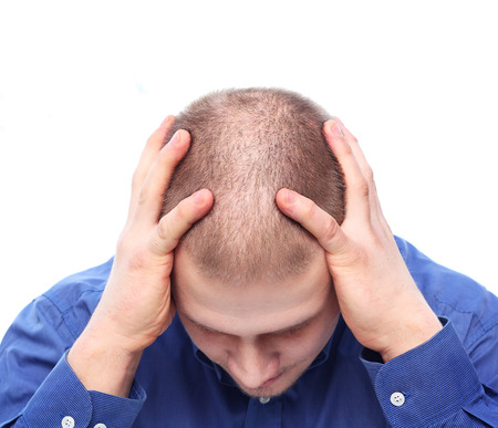 Young man with rare hair depressed.の写真素材