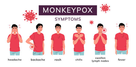 Monkey pox. Virus. Symptoms disease. Medical instructions and description. Fever, chills, muscle...
