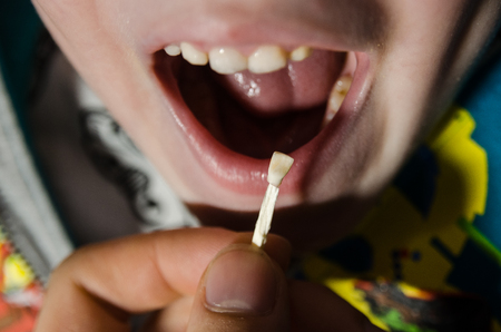 Child opening his mouth with a fallen tooth. Boy smilling in dentistry concept.の写真素材