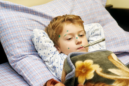 Sick child boy lying in bed with chicken pox