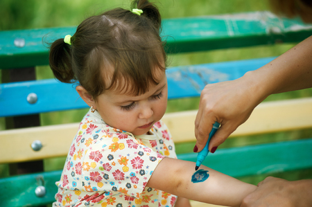 A child with an abrasion on his arm . Mom treats the woundの写真素材