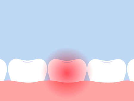 Toothache concept. Vector flat illustrationのイラスト素材