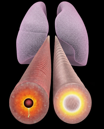 Asthma, bronchial section, length. Section of the bronchial tubes, 3d viewの写真素材