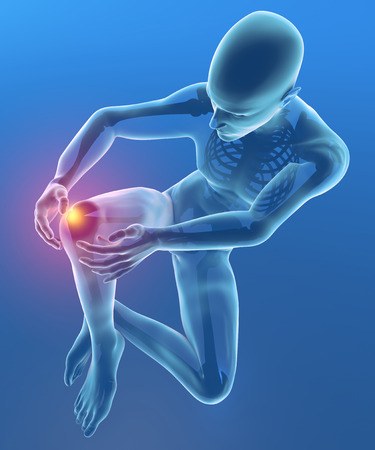 Inflammation of knee pain skeleton x-rayの写真素材