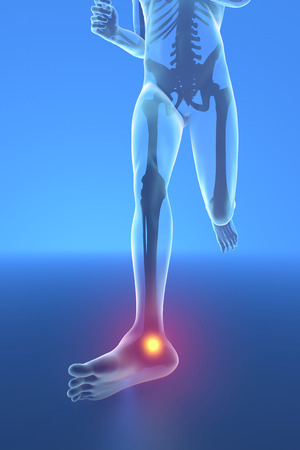 Man running with ankle pain breaking distortionの写真素材
