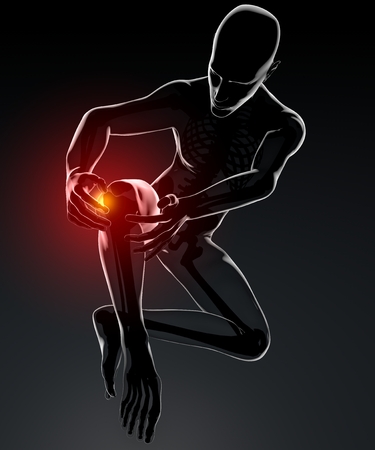 Inflammation of knee pain skeleton x-rayの写真素材