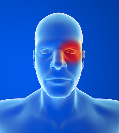 Type headache: Cluster pain is in and around one eyeの写真素材