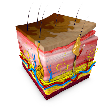 Tinea versicolor is a condition characterized by a skin eruption on the trunk and proximal extremities. The majority of tinea versicolor is caused by the globose Malassezia fungus, although Malassezia furfur is responsible for a small number of cases. Leather section. Rendering in 3dの写真素材