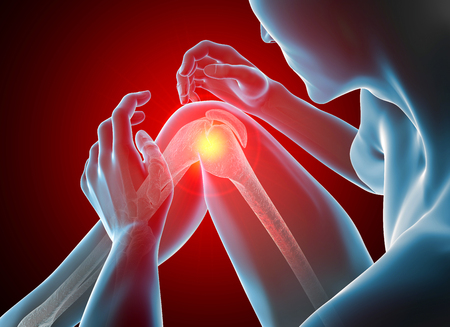 Man with knee pain, patella, skeleton and muscles, 3d render. radiographyの写真素材