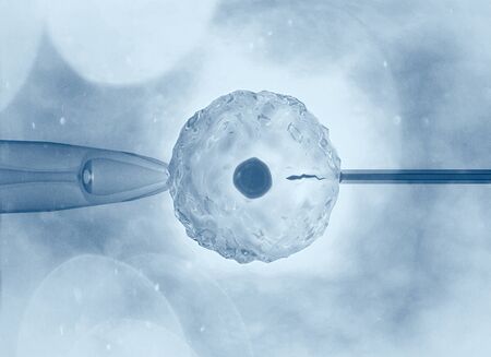 Artificial or assisted fertilization is the process by which the union of gametes is artificially carried out, by observation under a microscope, 3d renderingの写真素材