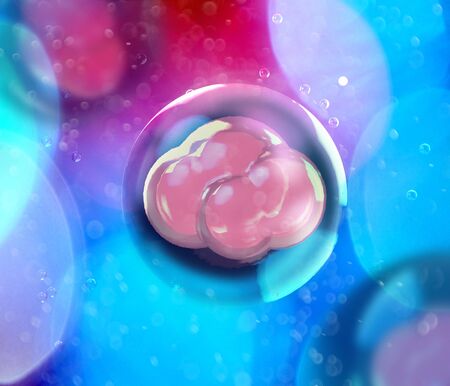 In vitro fertilization (IVF) is a process of fertilization. Consist in removing an ovum from the...