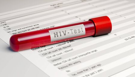 Test of the HIV virus, blood tube. Analysis to find out if you are infected with the virus. AIDS. The human immunodeficiency viruses, 3d renderの写真素材
