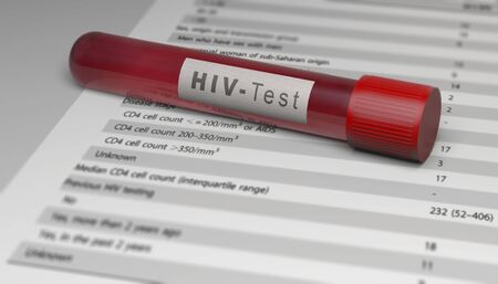Test of the HIV virus, blood tube. Analysis to find out if you are infected with the virus. AIDS. The human immunodeficiency viruses, 3d renderの写真素材