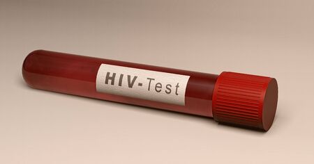Test of the HIV virus, blood tube. Analysis to find out if you are infected with the virus. AIDS. The human immunodeficiency viruses, 3d renderの写真素材