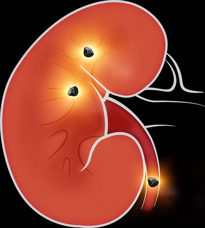 Human body view of kidneys. The kidneys are two bean-shaped organs found in vertebrates. Kidney stonesの写真素材