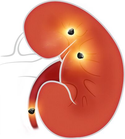 Human body view of kidneys. The kidneys are two bean-shaped organs found in vertebrates. Kidney stonesの写真素材