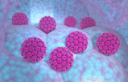 Human papillomavirus infection. Virus. HPV is the most common sexually transmitted infection globally. HPV infection is caused by human papillomavirus, DNA virus from the papillomavirus family, 3d renderingの写真素材