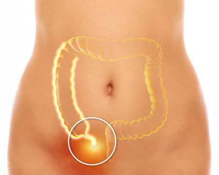 The appendix is a finger-like, blind-ended tube connected to the cecum. The cecum is a pouch-like structure of the colon. 3d render. Appendicitis is inflammation of the appendix.の写真素材