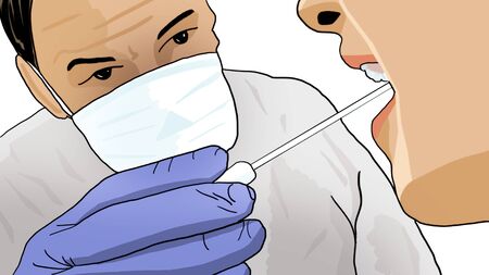 Doctor carrying out a swab on a patient. Covid-19. SARS-Cov-2. Countering the coronavirus emergency, prevention. Use of health tools to combat the spread of the virusの写真素材