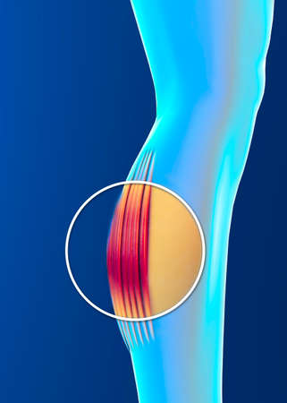 Muscle strain, inflammation of the muscles. Calf. Cramps. Tendons. Contracture. Human body and anatomy, fitness, physical exercises to keep in training. 3d renderの写真素材