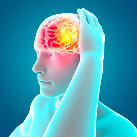 Pain in the head, brain and synapses, cognitive problems, mental deficit. Aneurysm. Generative...