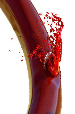 Hemorrhagic stroke. An artery ruptures, causing more or less extensive bleeding and damaging brain tissue. Brain damage. Neurology. Type of stroke. 3d renderの写真素材