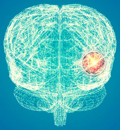 Memory lapses, forgetting things, degenerative disease. Brain problems. Parkinson and alzheimer desease. Mental health. Stroke, synapses and neurnons interaction. 3d renderの写真素材