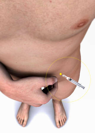 Subcutaneous injections of heparin on the belly. Bare-chested person and heparin syringe in the abdomen. Preventing blood clots. 3d renderingの写真素材