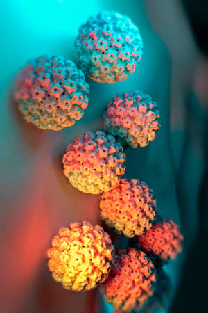 Human papillomavirus infection. Virus. HPV is the most common sexually transmitted infection...