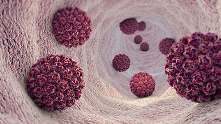 Human papillomavirus infection. Virus. HPV is the most common sexually transmitted infection globally. HPV infection is caused by human papillomavirus, a DNA virus from the papillomavirus family, 3dの写真素材