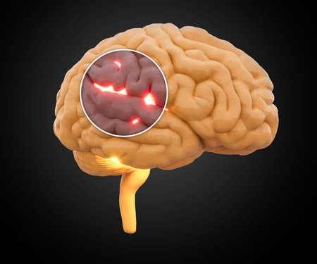 Pain in the head, brain and synapses, cognitive problems, mental deficit. Aneurysm. Degenerative diseases affecting the brain area. Parkinson and Alzheimer. 3d renderingの写真素材